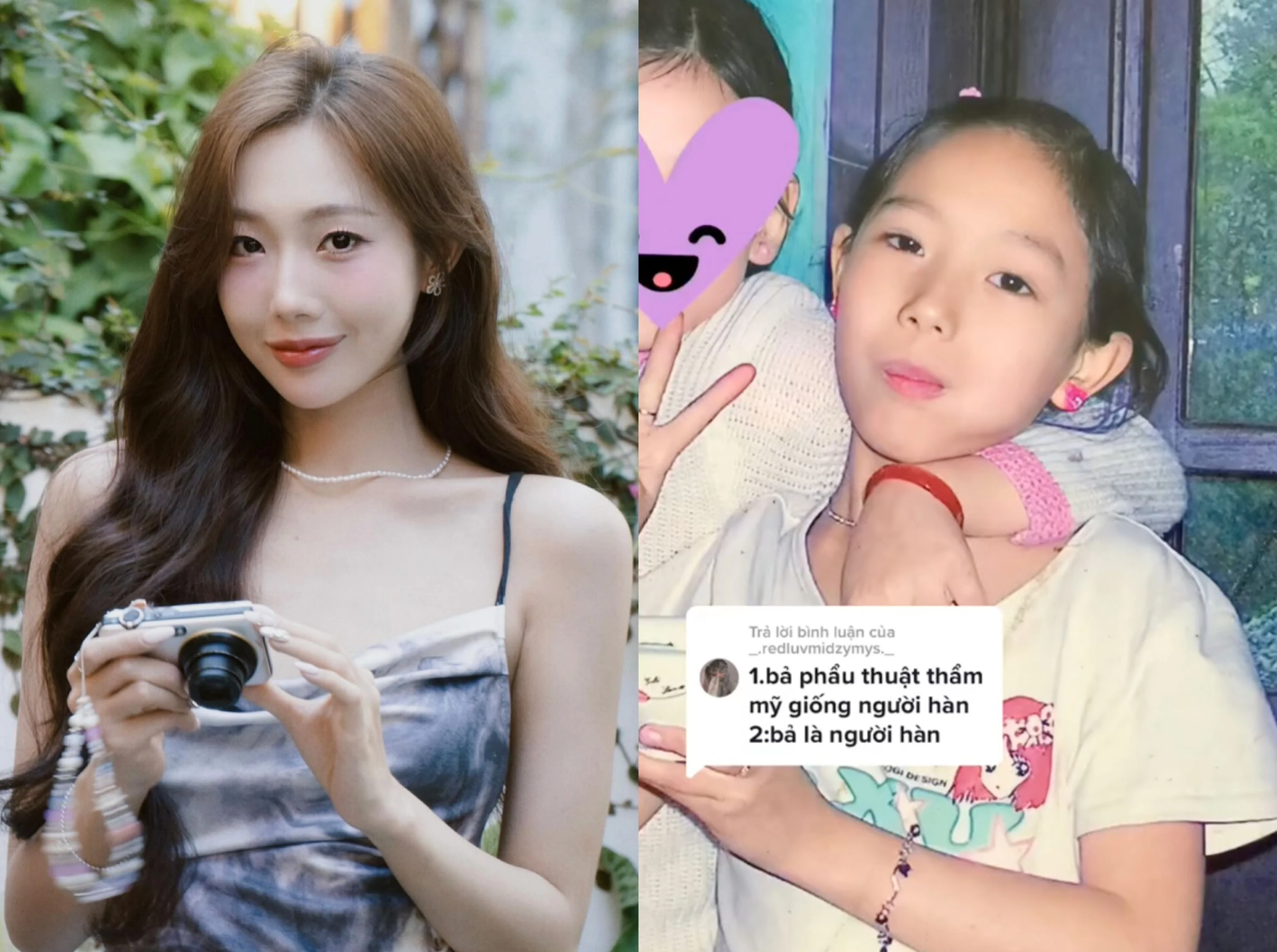 Gái xinh Đảo Thiên Đường lộ ảnh thời chưa tiêm filler, niềng răng