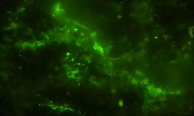 Với tên gọi thân thiện là "nấm khoáng vàng", vi khuẩn này có hình que, dài trung bình 4 micron, có khả năng di chuyển và hình thành bào tử. (Ảnh: Microbial Ecology)
