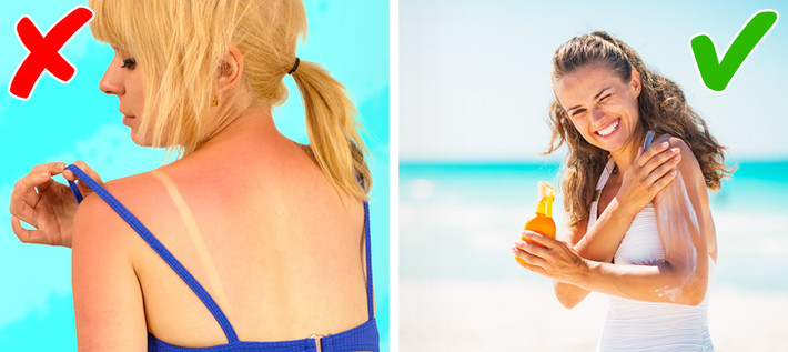 Tiếp xúc với ánh nắng mặt trời cũng là một trong những yếu tố khiến da bạn bị nổi nám. Hãy tránh đi ra ngoài khi Mặt trời hoạt động mạnh và sử dụng kem chống nắng thường xuyên. Ảnh BS.