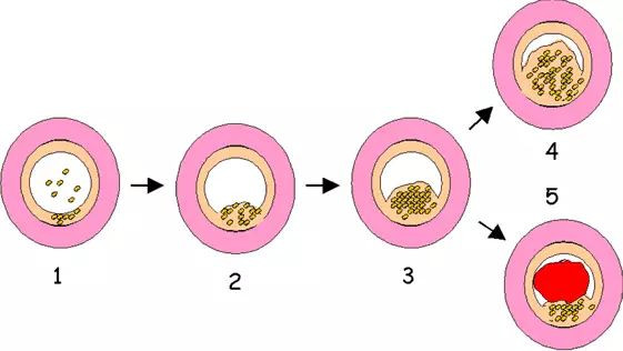 Trước hết, bạn cần hiểu thế nào được gọi là thực phẩm chứa cholesterol cao. Hiệp hội Tim mạch Hoa Kỳ khuyến cáo rằng, một ngày tối đa chỉ được tiêu thụ 300 mg cholesterol đối với người bình thường và 200mg với bệnh nhân đang có lượng cholesterol trong máu cao. Ảnh: kedo.
