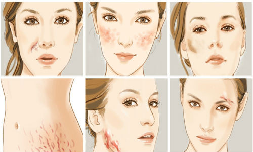 Sau cuộc trải nghiệm với vết sẹo trên mặt các tình nguyện viên đã có những cảm xúc đầy khác biệt. Có người cảm nhận được sự chê bai, coi thường của người khác nhìn mình, có người cảm thấy người khác sợ hãi khi gặp họ, còn rất ít người tỏ ra thân thiện hoặc cảm thông với những vết sẹo không mong muốn của người khác. Ảnh: sohu.