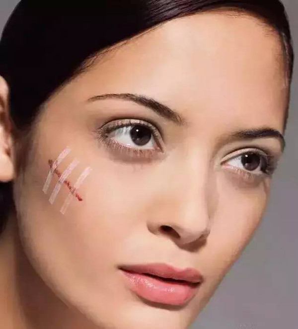 Chính những vết sẹo xấu xí này đã trở thành rào cản khá lớn trong cuộc sống của nhiều người. Nó khiến người ta đánh mất đi sự tự tin vào chính bản thân họ. Vì thế, nếu bạn không may phải phẫu thuật hãy bắt đầu từ việc chăm sóc để không làm những vết sẹo sau này ảnh hưởng đến cuộc sống của bạn. Ảnh: Sohu.