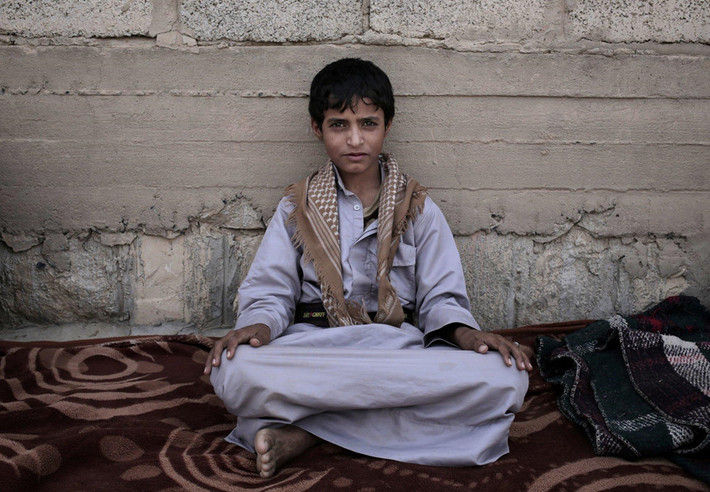 Abdel-Hamid, năm nay 14 tuổi, đang sống tại một trại tập trung ở Marib, Yemen. Cậu bé cho biết từng thấy những đứa trẻ bằng tuổi mình bị bắn chết vì không tuân lệnh. Ảnh: AP.