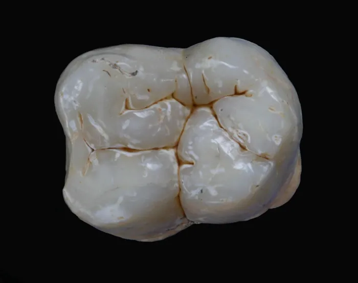 Các nghiên cứu sau đó chỉ ra rằng Gigantopithecus có kích thước răng lớn gấp ba đến bốn lần so với loài vượn lớn khác.