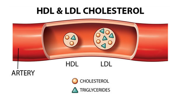 4. Dầu thực vật giúp giảm LDL cholesterol nhưng cũng gây giảm HDL cholesterol. Mọi người đều cho rằng dầu thực vật là một loại thực phẩm tốt vì giúp giảm mỡ xấu LDL cholesterol. Tuy vậy, đây cũng chỉ là giảm yếu tố nguy cơ chứ không phải ngăn ngừa được bệnh. Trong khi đó, dầu thực vật cũng gây giảm nhẹ HDL cholesterol (mỡ tốt) và các nghiên cứu cũng chỉ ra giảm HDL làm tăng nguy cơ các bệnh lý tim mạch.