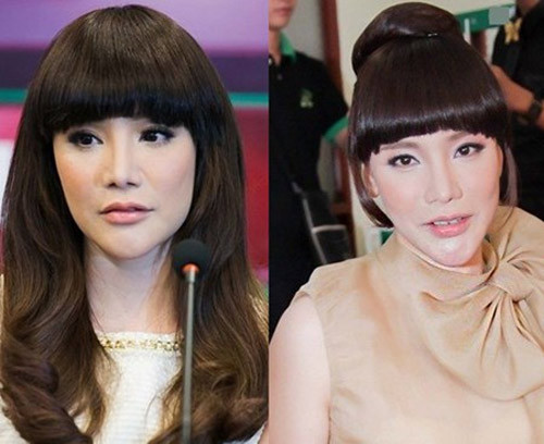Chiếc cằm bất thường vô tình khiến các ngôi sao bị vướng vào "nghi án" trùng tu sắc đẹp bằng dao kéo. Hồ Quỳnh Hương là một trong những trường hợp điển hình.