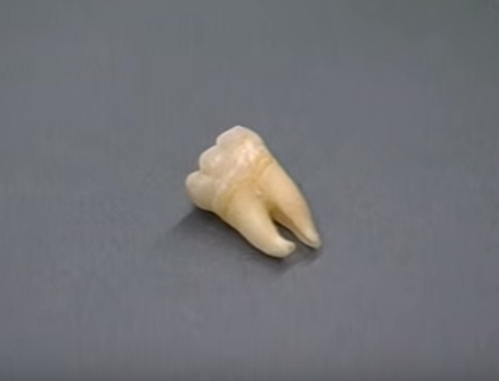 Đúng lúc các điều tra viên bế tắc, một chuyên gia pháp y hàng đầu về răng đưa ra ý tưởng phân tích DNA từ một răng khôn của nạn nhân. Vì chiếc răng này nằm dưới xương hàm nên nó chịu tác động của ngọn lửa ở mức thấp nhất so với những răng khác. Đây là ý tưởng táo bạo, vì trước thời điểm ấy, chẳng nhà khoa học nào phân tích DNA từ răng.