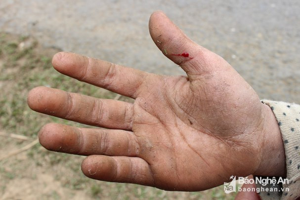Lá đót vốn rất sắc, lũ trẻ vùng cao lại không có bất kỳ dụng cụ bảo hộ nào nên việc bị đứt tay là điều thường gặp. Ảnh: Đình Tuân