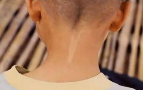 Con gái của bà nhúng ngón tay vào một hồ trắng và đánh dấu sau cổ của bà.