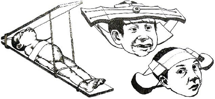 Khi ấy, những đứa trẻ sẽ có hộp sọ giống hình quả trứng, thậm chí bị cho là có hộp sọ giống người ngoài hành tinh.