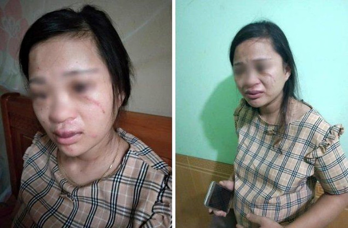 8. Chồng đánh vợ bầu 8 tháng vì mua hàng online: Ngày 28/7, chị Lê Thị Kim T. (22 tuổi, trú tại xóm Đông Hà, xã Đông Hiếu, thị xã Thái Hòa, tỉnh Nghệ An) bị chồng là T.A. đánh dù đang mang bầu 8 tháng vì lén mua một đôi giày trị giá 135.000 đồng trên mạng. Tiếp nhận được thông tin sự việc, công an xã Đông Hiếu đã triệu tập anh T.A đến trụ sở cơ quan để làm rõ vụ việc.
