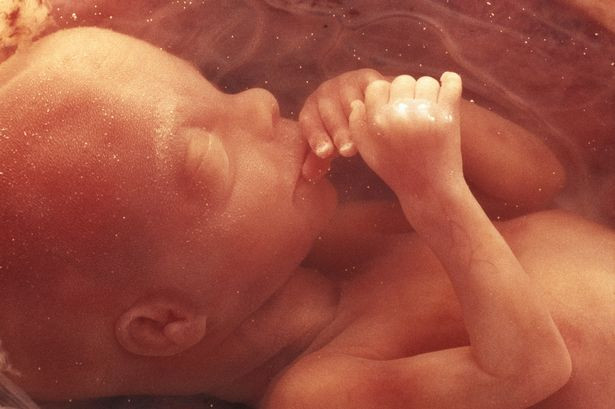 Dây rốn có thể bị tắc trong quá trình sinh em bé và cần phải có sự hỗ trợ của bác sĩ trong trường hợp này. Trường hợp không thể gỡ rối được dây rốn, các bác sĩ sẽ buộc phải cắt dây, tuy nhiên việc làm này không được khuyến khích.
