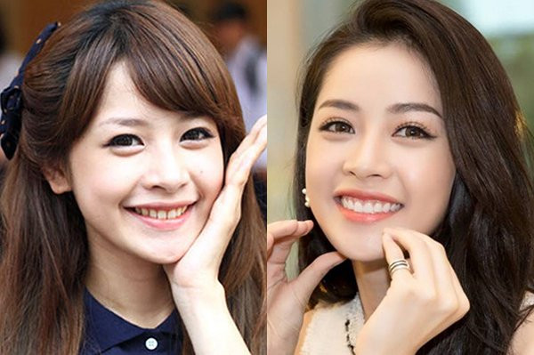 Ở tuổi 26, Chi Pu đạt đến độ chín về nhan sắc. Cô có lượng fan đông đảo nhờ diện mạo yêu kiều, hoàn hảo mỗi khi xuất hiện.