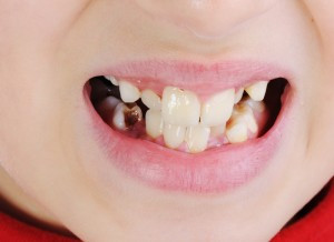 Những người phụ nữ này là kiểu người sống giả dối, họ luôn có những hành vi và lời nói thiếu thành thật trong mọi chuyện. Vì vậy, khi gặp gỡ với những người phụ nữ tướng này bạn nên tránh xa không nên quá thân thiết kẻo gây thị phi.