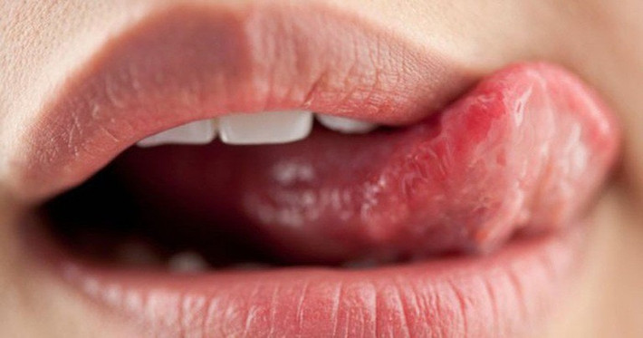Dị ứng: Có nhiều loại dị ứng có thể gây ra khô môi, trong đó có dị ứng với coban và niken. Nếu bạn dùng quá nhiều chất bổ sung vitamin B12, nó có thể gây ra dị ứng với coban, dẫn tới khô môi và bong tróc môi.