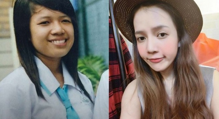 Nguyễn Thị Minh Yến, sinh năm 1991, TP.HCM chi hàng trăm triệu đồng để phẫu thuật thẩm mỹ. Quá trình thay mặt - đổi đời bắt đầu từ tháng 7/2013 và đến nay cô đã có nhan sắc hoàn hảo, vận may cũng liên tục xuất hiện.