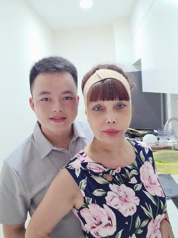 Liên tục gặp biến chứng sau phẫu thuật thẩm mỹ ở tuổi ngoài 60 khiến cô dâu Thu Sao nhận được rất nhiều sự quan tâm của dư luận.