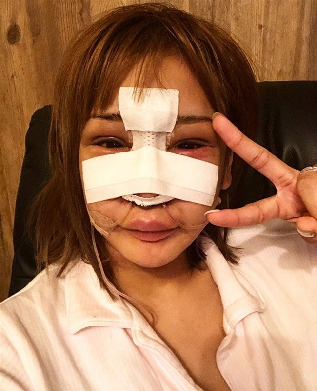 Bị chê về nhan sắc, Nonoka Sakurai - cô gái người nhật đã liên tục phẫu thuật thẩm mỹ 100 lần trong 10 năm để có một diện mạo xinh đẹp động lòng người.