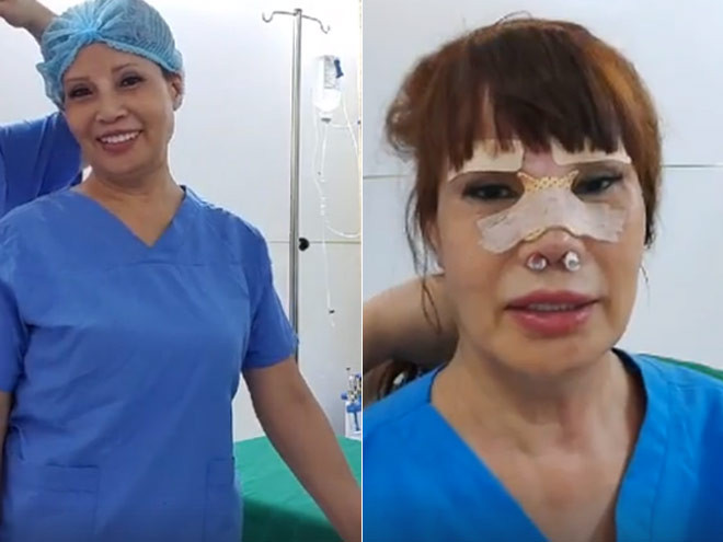Mới đây, cô dâu Thu Sao một lần nữa khiến nhiều người chú ý khi thông báo đang chữa méo miệng vì thẩm mỹ hỏng. Cô chia sẻ: "Mỗi ngày đều như vắt chanh nằm mỗi phòng 20 phút. Thứ 7 và chủ nhật nghỉ bởi vì chạy điện bệnh nhân ai cũng mệt mỏi. Quy định rồi nên muốn chạy ngày nghỉ cũng không được các bạn ạ. Trên nhà mình thì nghỉ hết, ở đây lại dư thời gian, xót hết cả ruột".