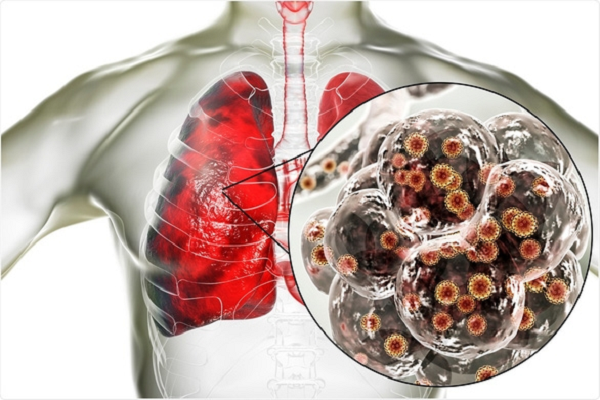 Vì vậy, các nhà khoa học đã kết luận rằng virus SARS-CoV-2 là bệnh lây truyền theo mùa như cúm. Do đó, tốc độ lây lan của nó phụ thuộc vào nhiệt độ và độ ẩm.