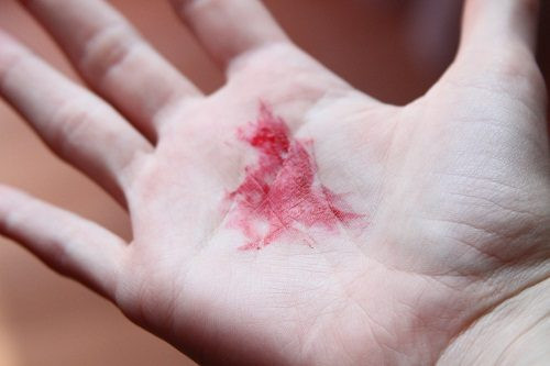 Ăn chín, uống sôi, đảm bảo vệ sinh. Chăm chỉ vận động luyện tập thể dục, duy trì cân nặng hợp lý.