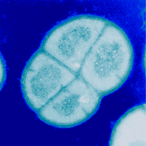 Vi khuẩn Deinococcus radiodurans được xem là loài sinh vật duy nhất có khả năng khôi phục lại bộ gen bị nứt làm hàng nghìn mảnh. Một nhóm các nhà nghiên cứu đã phát hiện những giai đoạn của sự phục hồi này cho phép con vi khuẩn sống lại sau khi trải qua mức độ bức xạ cực mạnh.