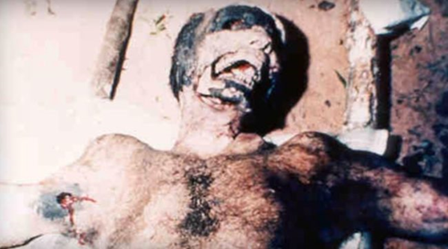 5. Xác chết vô danh không toàn thây Vào năm 1994, xác một người đàn ông được tìm thấy ở Brazil trong tình trạng bị xiên. Toàn bộ nội tạng của người này bị moi ra thông qua một cái lỗ lớn trên ngực. Nhiều người cho rằng người đàn ông này vẫn còn sống khi nội tạng bị moi ra, và cuối cùng chết bởi một cơn đau tim do quá đau đớn và bị sốc. Giám định pháp y kết luận rằng nội tạng của người đàn ông này bị hút ra khỏi cơ thể bằng một dụng cụ giống như máy hút bụi. Một bộ phận bị mất nữa của cái xác là mắt trái, tai trái và môi. Toàn bộ thi thể của người đàn ông vô danh nhầy nhụa máu. Nhiều người tin rằng người đàn ông này là nạn nhân của một nhóm người ngoài hành tinh chuyên thực hiện thí nghiệm cơ thể người Trái đất.