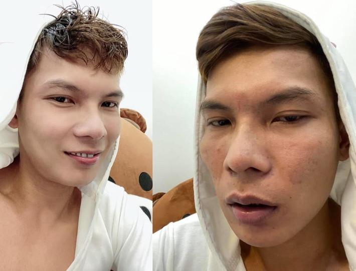 Trước đây Lộc Fuho từng gây chú ý với những phát ngôn về ngoại hình. Theo đó, anh chẳng ngại ngần khi cho rằng vẻ đẹp của mình "đánh bại" cả showbiz.