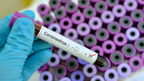 “Khi virus có nhiều lần lây truyền sang các loài khác thì nó sẽ biến đổi nhiều hơn. Một trong những loại virus mới này sau đó có thể trở thành SARS-CoV-3”, - ông nói thêm.