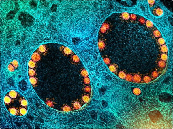 Nhà khoa học này cho rằng kịch bản lây truyền virus như vậy có thể xảy ra trong trường hợp có con dơi bị nhiễm bệnh khi ăn phải trái cây bị một người mắc bệnh cắn vào và bỏ lại.