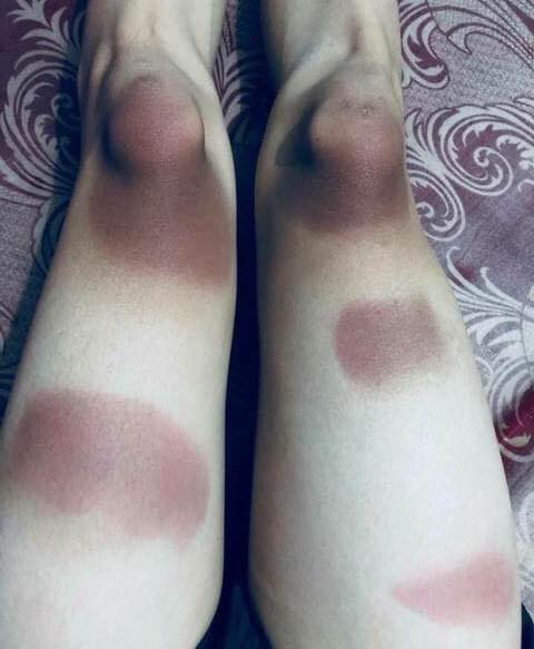 Những hình ảnh cháy nắng nhìn thôi không biết nên khóc hay nên cười bởi sự độc đáo và hài hước của nó.