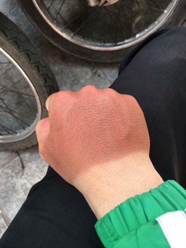 Kể cả có che chắn kỹ lưỡng cỡ nào thì vẫn có những chỗ không thể che tới và đó chính là mục tiêu “ tấn công” của nắng.
