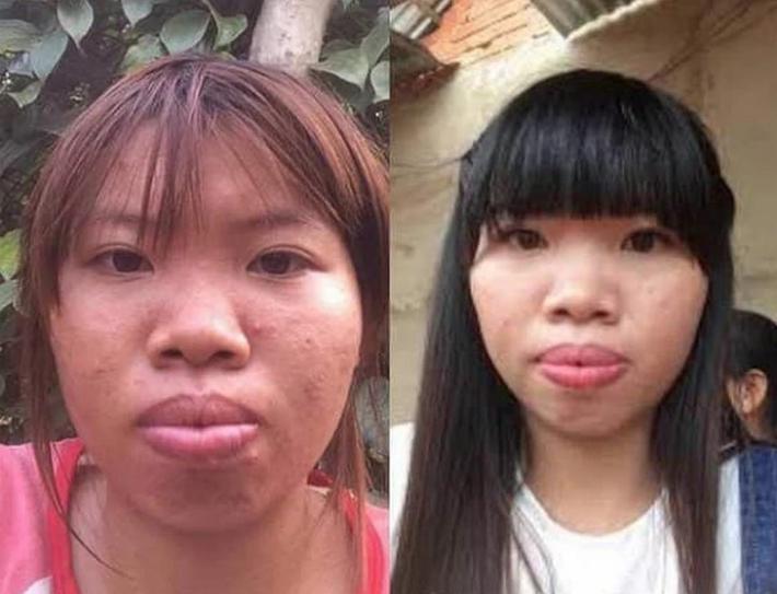 Ngoại hình trước đây của Quách Phượng khiến cô luôn tự ti với mọi người xung quanh bởi lời lẽ miệt thị, chê bai.