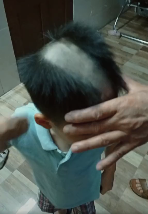 Những trường hợp "thảm hoạ" sau khi cắt tóc tại nhà xảy ra không ít, mà phần lớn là từ bàn tay khéo léo của người cha, người mẹ "tự xử" mái tóc cho con mình.