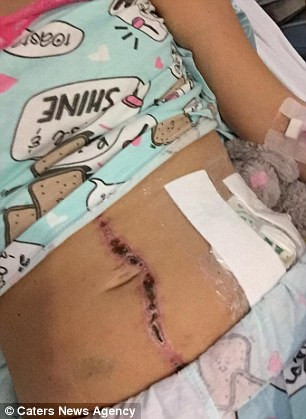 Sau 3 tháng điều trị ở bệnh viện, vết thương của Chloe Meade bắt đầu lành lại.