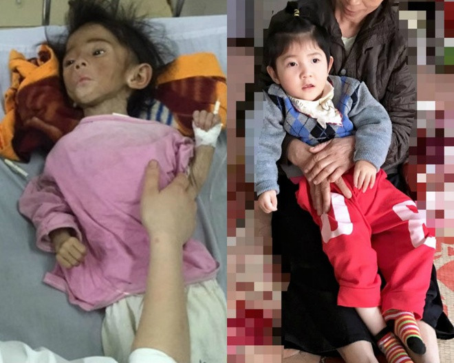 Hơn 4 năm trước, Phạm Thanh Tâm (29 tuổi) nhận nuôi bé bại não Thào Thị Yến Nhi ở Lào Cai khi em 14 tháng tuổi và chỉ nặng 3,5 kg. Hành động đẹp của cô gái trẻ khi đó đã chạm tới trái tim nhiều người, được tán dương trên mạng xã hội.