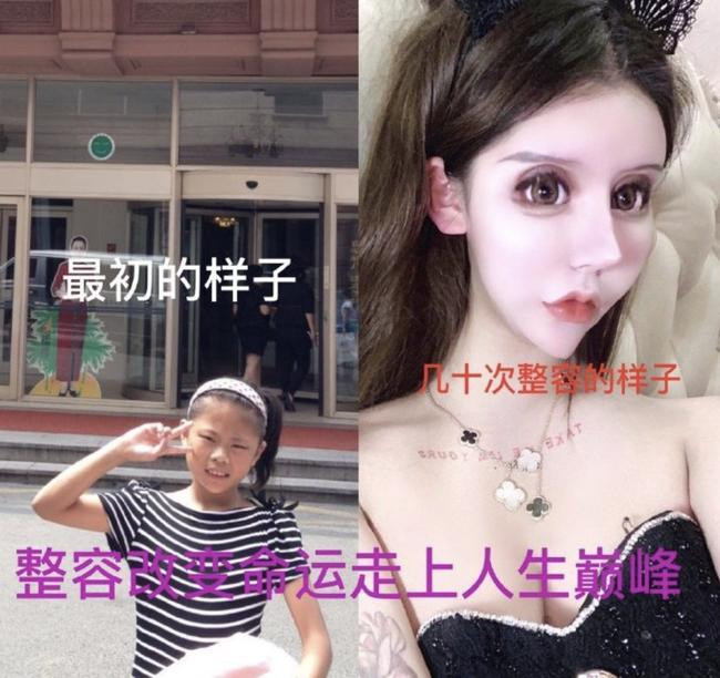 Mới đây, " mẫu nữ mặt rắn" này đã tiết lộ trên trang Weibo rằng mình đã trải qua hơn 100 ca phẫu thuật thẩm mỹ, không phải chỉ dừng lại ở con số 70 lần.