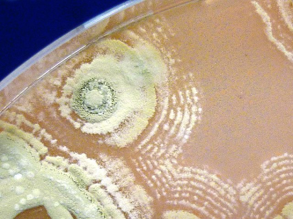 Đó là một loạt nấm và vi khuẩn bao gồm Actinobacteria (vi khuẩn giúp phân hủy vật liệu thực vật) và Firmicutes (giúp tăng trưởng thực vật, kiểm soát mầm bệnh) và nấm men chịu nhiệt Basidioacus hay Penicillium.