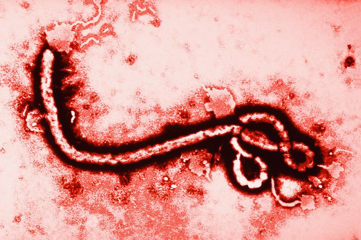Ebola: Tên đầy đủ của bệnh là sốt xuất huyết Ebola. Bệnh thường gây xuất huyết ở các cơ quan nội tạng và chảy máu từ miệng, mắt, tai, mũi và những vết hở trên da.