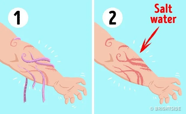 Bị sứa "chích", làn da, cơ thể nạn nhân sẽ có phản ứng khá mạnh như dị ứng, sốc thần kinh có thể bị nhiễm độc mạnh. Vậy nên khi không may gặp phải, cần làm sạch vết thương và loại bỏ phần còn lại của xúc tu sứa, rửa sạch vết thương bằng nước muối và dùng giấm táo, hoặc rượu bôi lên vết thương rồi tới gặp bác sĩ để được tư vấn.