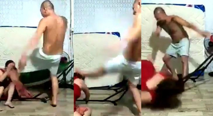 Hậu quả khi bị chồng đánh, chị K. bị tổn thương phần mềm, một số bộ phận trên cơ thể bị trầy xước bầm tím, đầu bị sưng do va đập mạnh. (Ảnh: Congly)