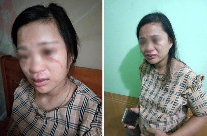 Chồng đánh vợ bầu 8 tháng vì mua hàng online 135.000 đồng: Ngày 28/7, chị Lê Thị Kim T. (22 tuổi, trú tại xóm Đông Hà, xã Đông Hiếu, thị xã Thái Hòa, tỉnh Nghệ An) bị chồng là T.A. đánh dù đang mang bầu 8 tháng vì lén mua một đôi giày trị giá 135.000 đồng trên mạng. Tiếp nhận được thông tin sự việc, công an xã Đông Hiếu đã triệu tập anh T.A đến trụ sở cơ quan để làm rõ vụ việc. Người phụ nữ bị đánh dã man vì lên mạng nói xấu chồng vô tâm. (Nguồn: VTC14)