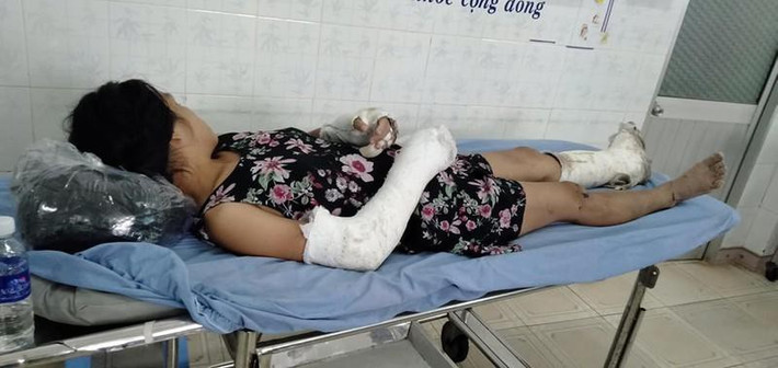 Chồng đánh vợ bầu vỡ nền sọ não, gãy tay chân: Ngày 16/8, chị Lâm Thị Mến (31 tuổi, trú tại xã Huy Kiêm, huyện Tánh Linh, tỉnh Bình Thuận) đã bị chồng là Huỳnh Văn An (26 tuổi, trú cùng địa bàn) dùng cây gỗ dài đánh đập lên đầu, tay, chân. Sau đó, chị Mến bỏ chạy ra khỏi nhà thì anh An dùng dao đuổi theo chém liên tiếp vào người. Nguyên nhân xảy ra vụ việc do xảy ra mâu thuẫn sau khi anh Anh đi nhậu về. (Ảnh: Thảo Nguyên)