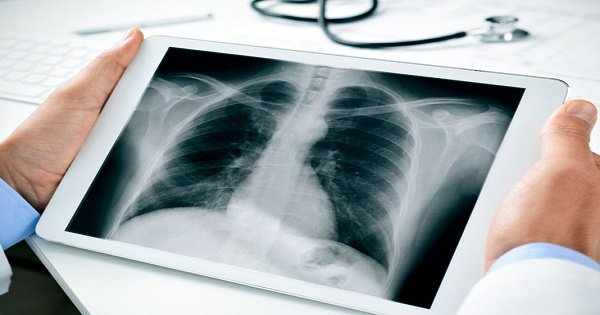 Wilhelm Röntgen đã phát hiện ra tia phóng xạ có khả năng xuyên qua tấm bìa cho bên ngoài của ống, tác động lên một hợp chất phía sau làm nó phát sáng lên. Những nghiên cứu tiếp theo càng chỉ ra rằng ông đã tạo ra một loại bức xa mới, đặt tên là "tia X", có khả năng xuyên qua hầu hết mọi vật thể, kể cả da thịt con người.