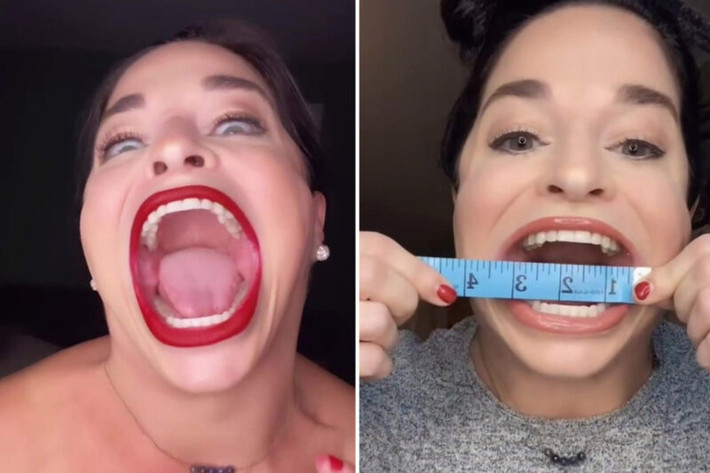 Samantha Ramsdell, cô gái đến từ Connecticut, Mỹ đáng trở thành một hiện tượng mạng với số người đăng ký theo dõi cực khủng trên Tik Tok khi sở hữu khuôn miệng rộng nhất thế giới.