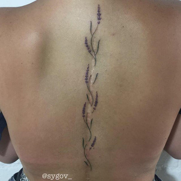 Khó có thể nhận ra vết mổ kéo dài dọc xương sống trên lưng của người này.