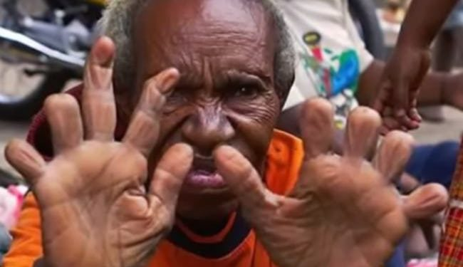 Bộ tộc Dani, sống tại Thung lũng Baliem ở Tây Papua, Indonesia, có một nghi lễ tang lễ đặc biệt và đầy đau đớn: tục cắt cụt ngón tay của phụ nữ để bày tỏ lòng thương tiếc khi người nhà qua đời. (Ảnh:orissapost)
