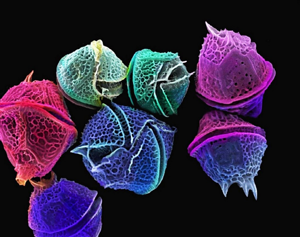 Tảo Dinoflagellates thực chất là một loài động vật đơn bào gây ra hiện tượng tự nhiên còn được gọi là “thủy triều đỏ”.