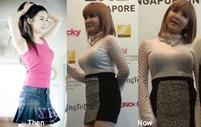 Hình ảnh xưa và nay của Park Bom bị mang ra so sánh.