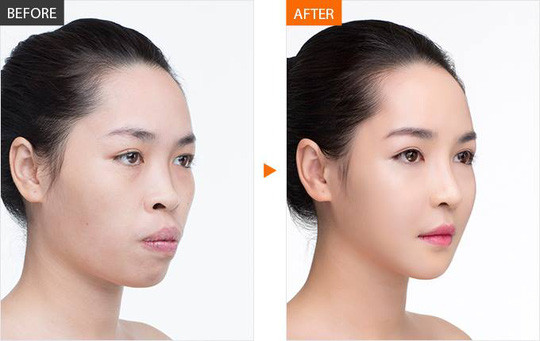 Giờ đây, các đường nét trên gương mặt Quỳnh ngày càng hoàn thiện và tự nhiên. Cô cho biết bản thân không tác động thêm một lần dao kéo nào khác cũng như bảo dưỡng sau phẫu thuật. Những chỉnh sửa của hot girl là vĩnh viễn nhưng cũng mang rủi ro "được ăn cả, ngã về không". Thời gian gần đây, Quỳnh bay qua lại Việt Nam - Hàn Quốc khá nhiều, thời tiết thay đổi liên lục nhưng không cảm thấy đau nhức gì.